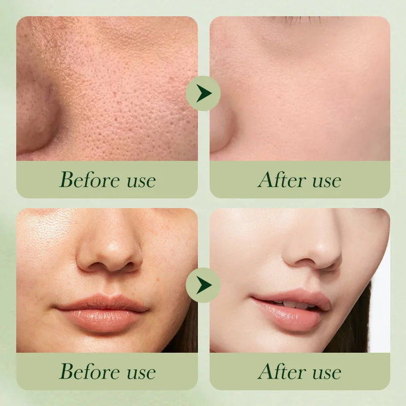 ITGIRLSOCIETY Avocado Nourishing Skincare 6-Piece Set